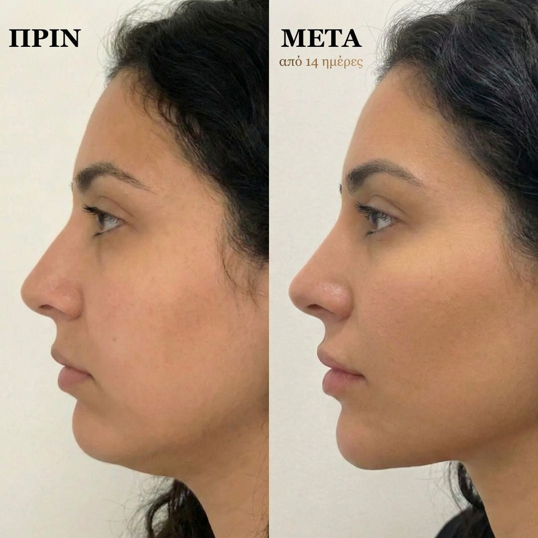 Βούρτσα Λεμφικού Μασάζ Προσώπου