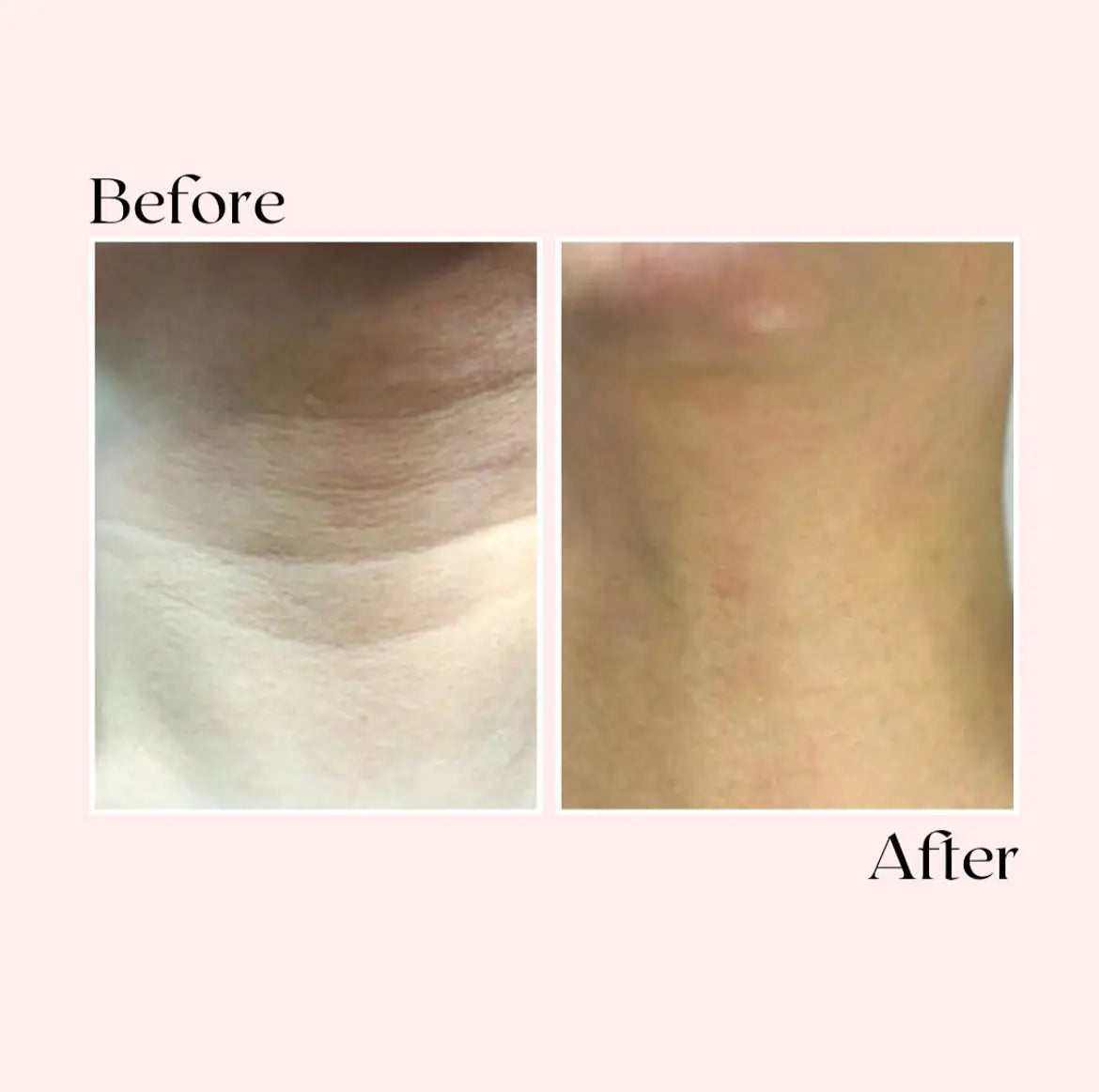 Glassy® Microneedling Serum